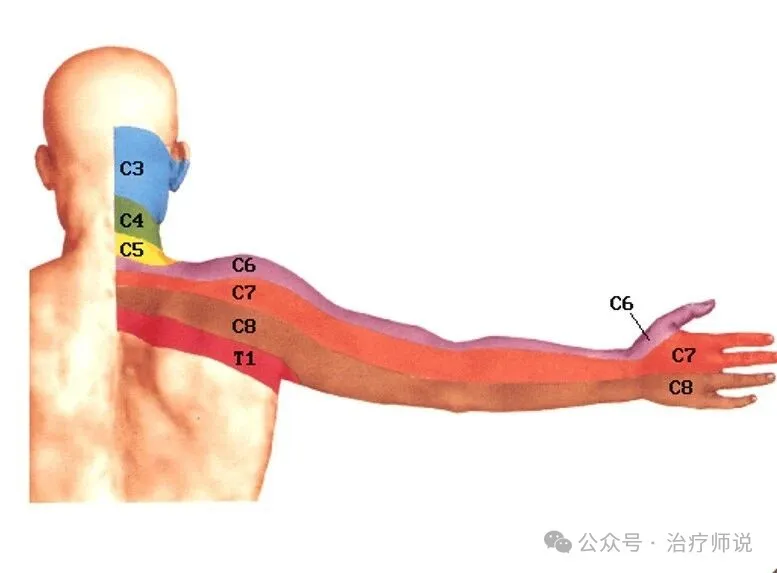 Numb Fingers: Which Cervical Level Is the Cause? The Answer Isn't What You'd Expect